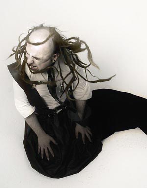 ALOPECIA