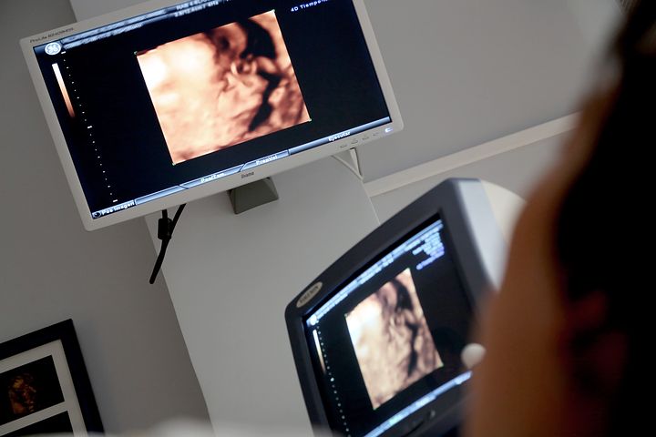 ¿Cómo actúan los cinco sentidos básicos en el feto?