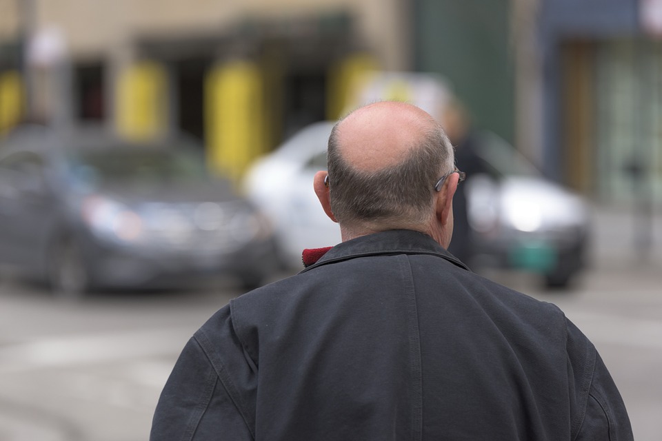 ¿Cuántos tipos de alopecia existen y en qué consisten?